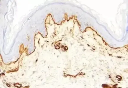 [A1020-5] GnRH Associated Peptide (GAP) (1-13), human - 5mg